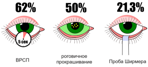 Катаракта синдром сухого глаза лечение