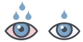 Синдром сухого глаза глаукома